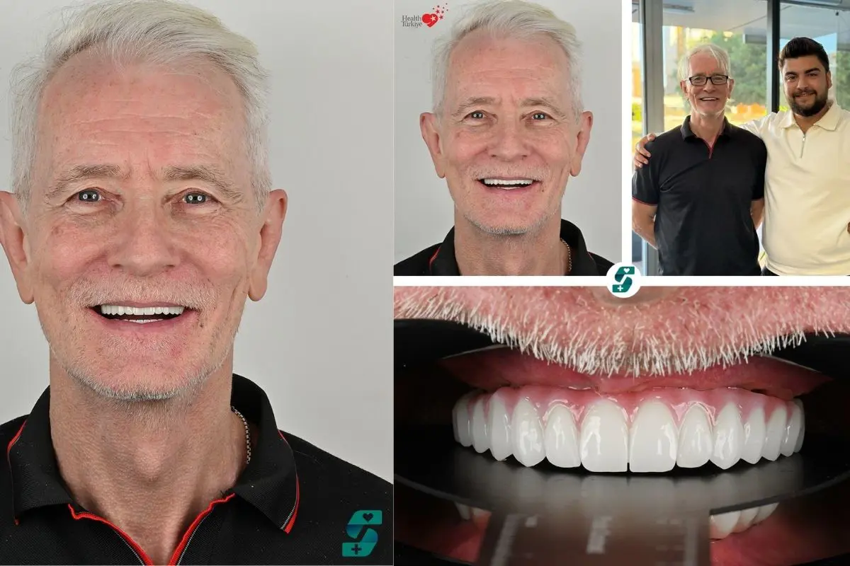 All on 4 cena w Turcji Antalya