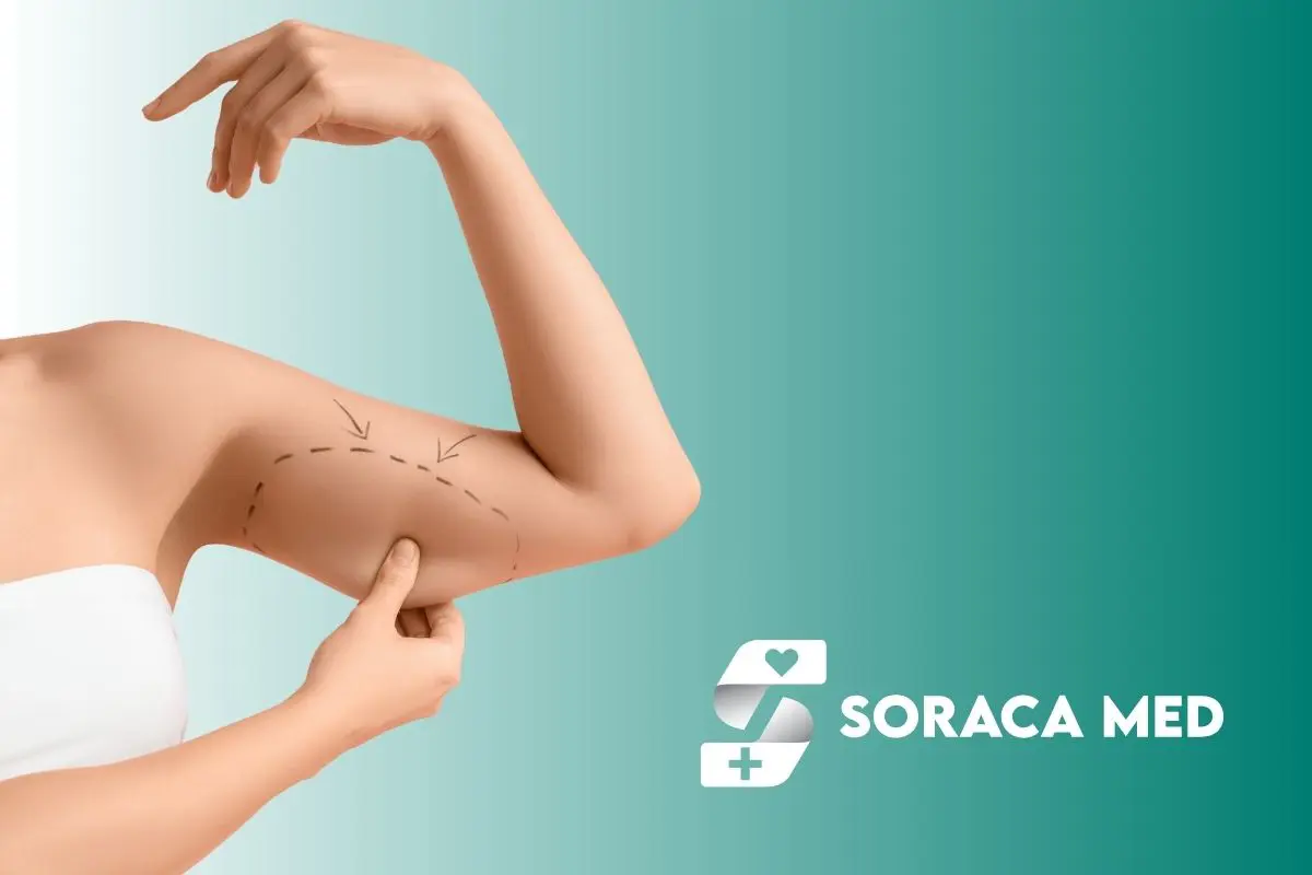 Benefits Of Mini Arm Lift Surgery