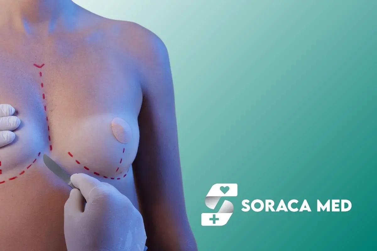 Breast Implant Surgery Cost Breakdown