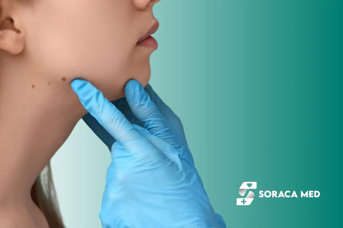 Does Mole Removal Leave A Scar