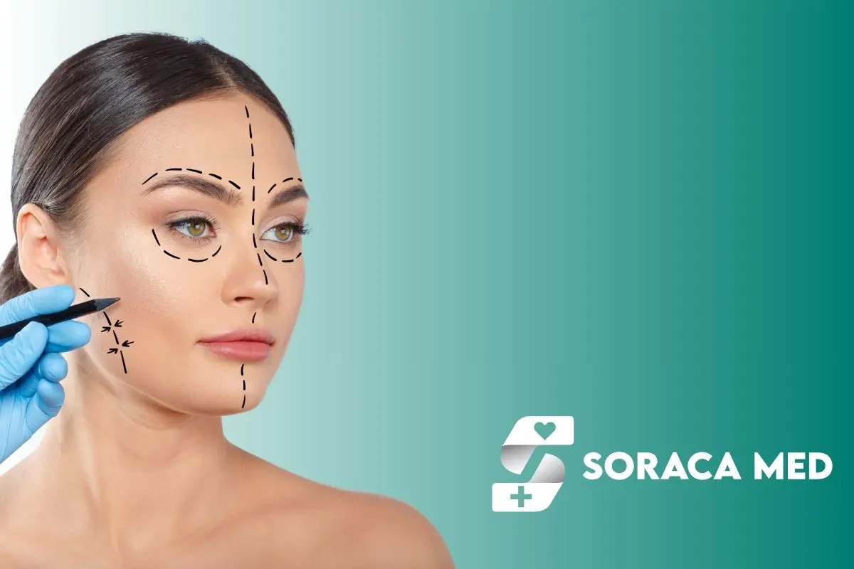 Double Eyelid Surgery in Turkey