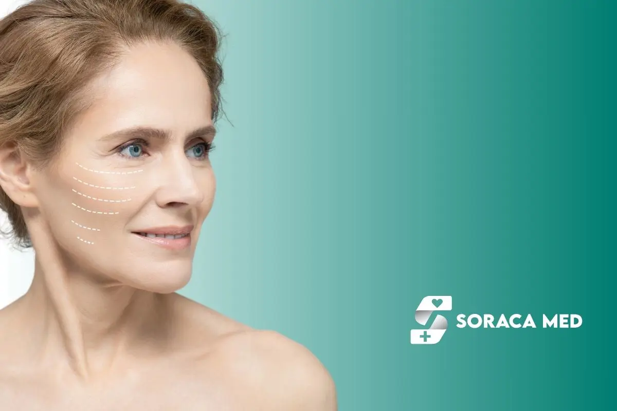 Facelift Vorher Nachher &Amp; Ergebnisse