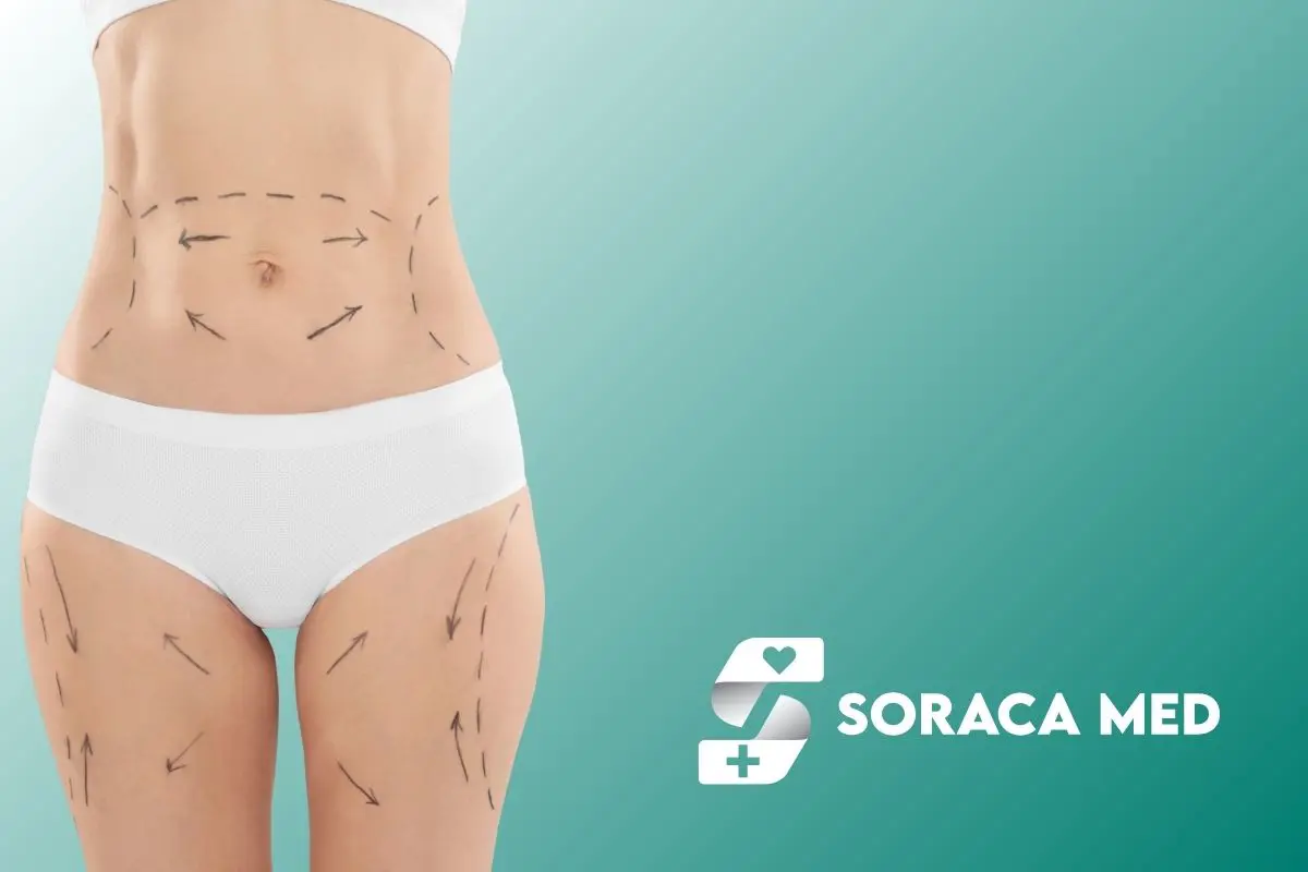 Jak Wygląda Proces Liposukcji W Antalyi