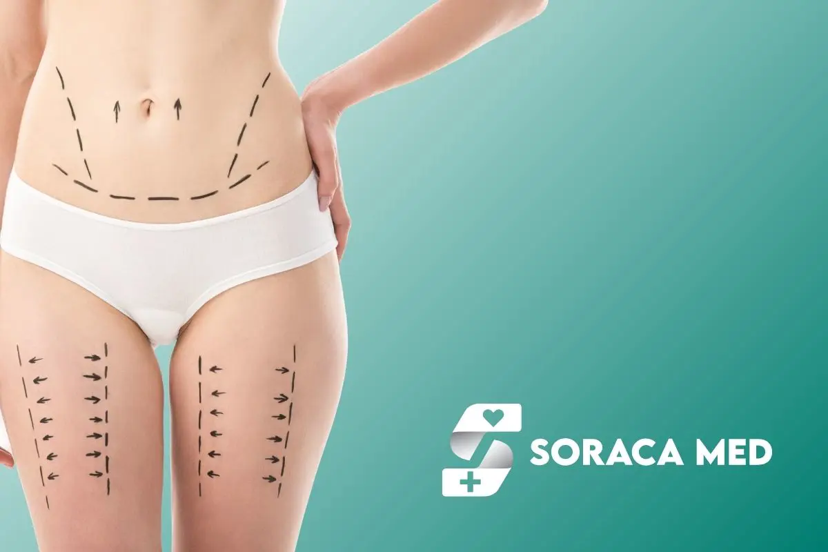 Liposukcja brzucha cena w Antalyi