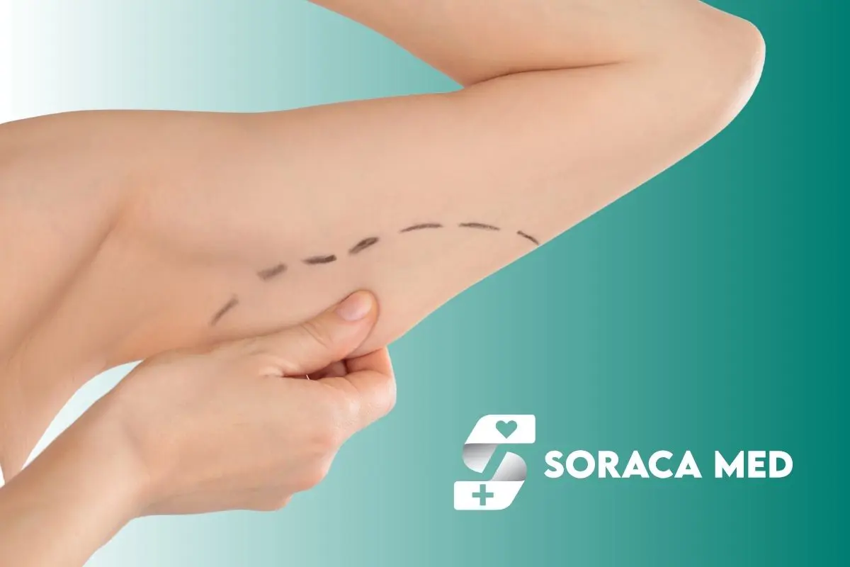 Mini Arm Lift Cost In Turkey