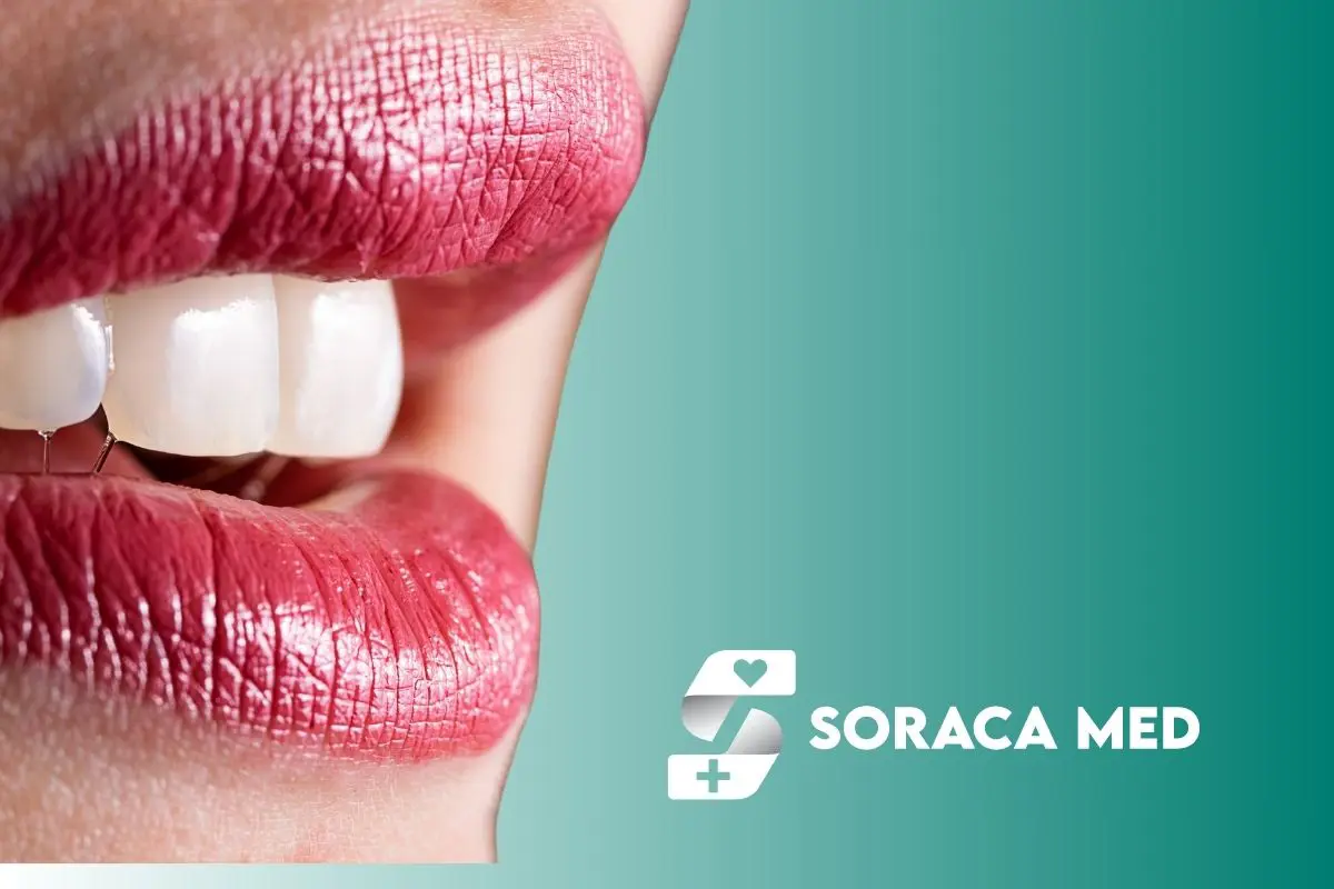 Licówki W Turcji: Ceny, Efekty I Wszystko Co Musisz Wiedzieć