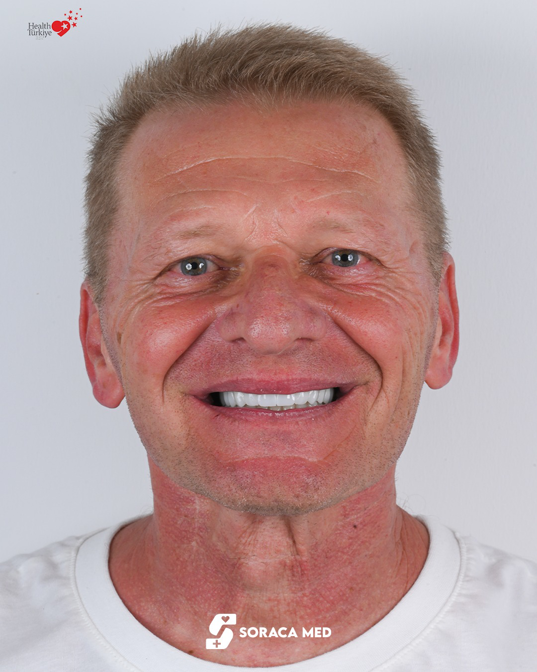 Dental Treatment Price List 12 Dental Treatment Price List