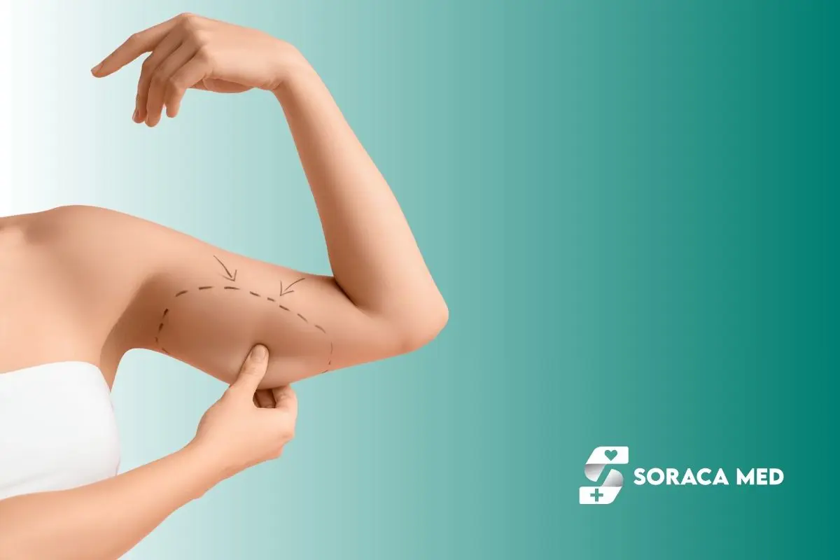 Arm Liposuction Cost in Antalya