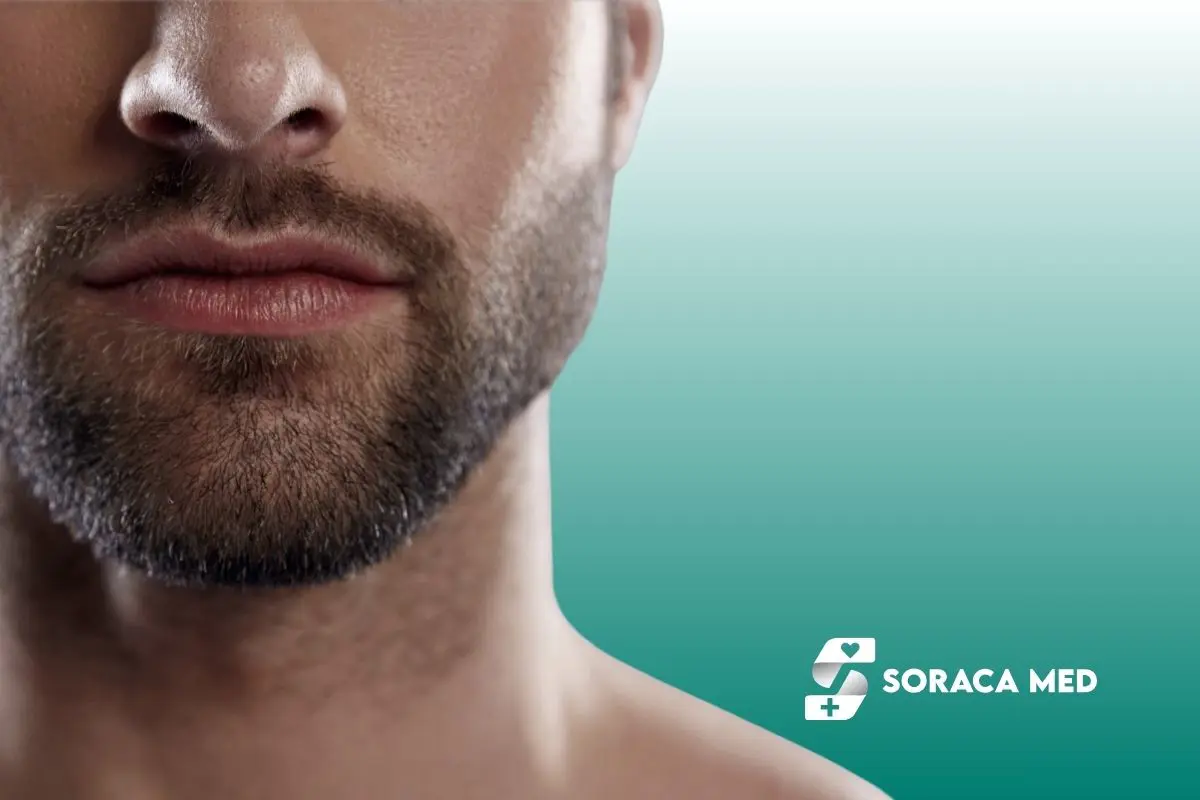 Beard Hair Transplant Before And After Results