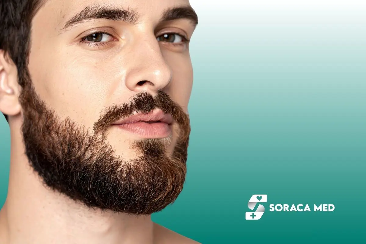 Fue Beard Transplant Technique