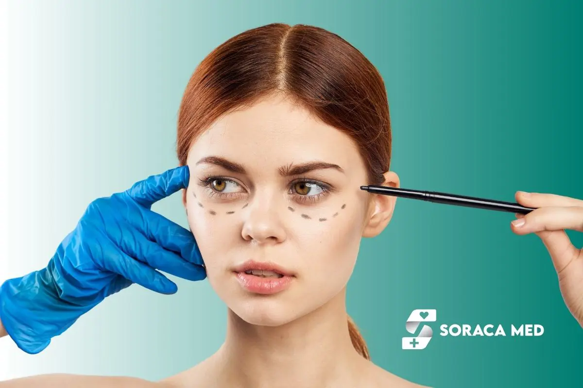 Fox Eye Surgery in Antalya