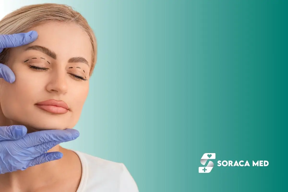 Recovery Upper Eyelid Surgery