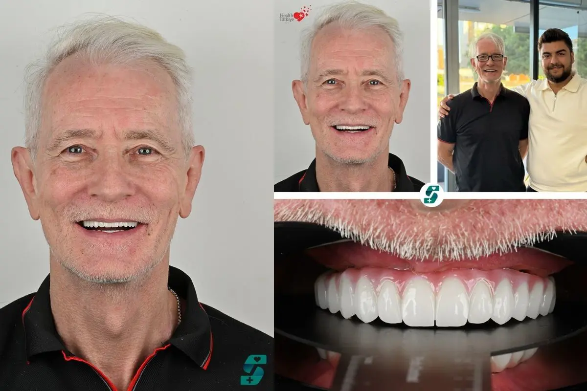 Dental Implants Cost in Antalya: A Complete Price Guide for Patients 3 Treatment Timeline For Dental Implants In Antalya
