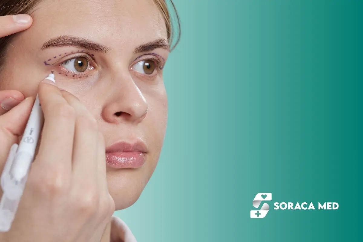 Upper Eyelid Surgery Prices in Antalya