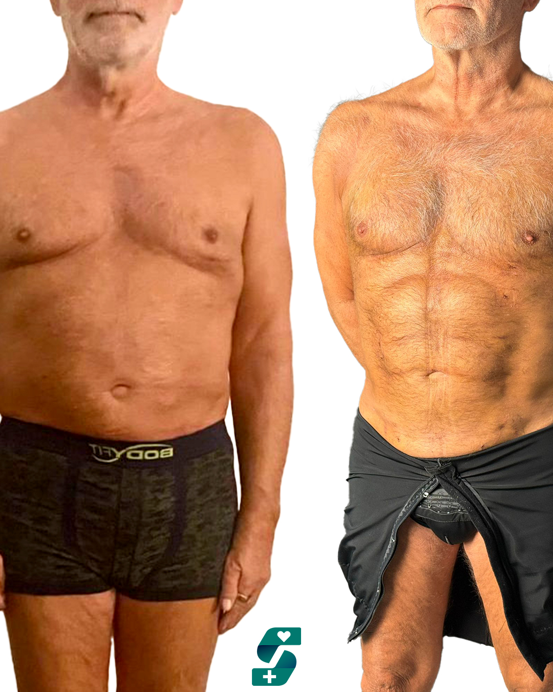 Aesthetic Surgery Price List in Antalya 8 Aesthetic Surgery Price List In Antalya