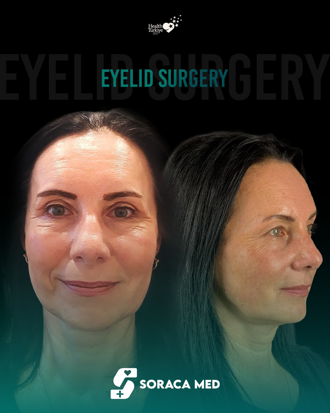 Aesthetic Surgery Price List in Antalya 10 Aesthetic Surgery Price List In Antalya