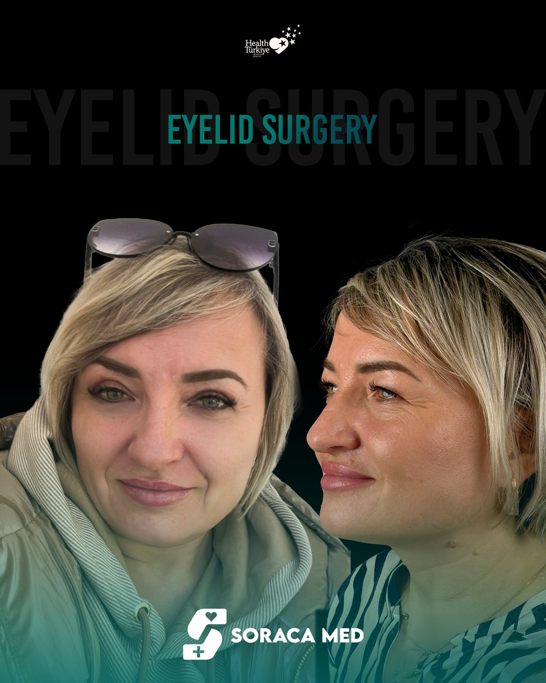 Aesthetic Surgery Price List in Antalya 11 Aesthetic Surgery Price List In Antalya