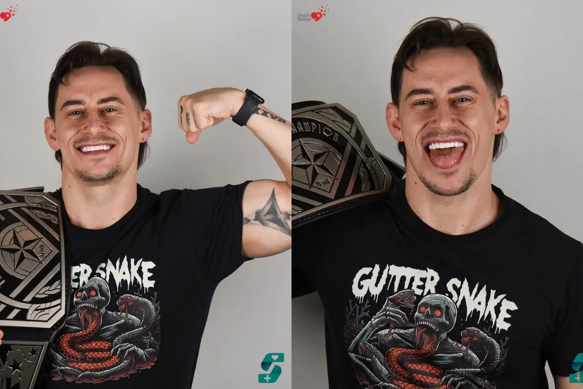 E-Max Veneers Vs. Keramik Veneers