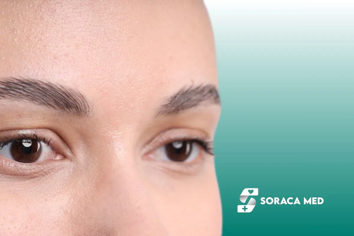 Eyebrow Transplant Results