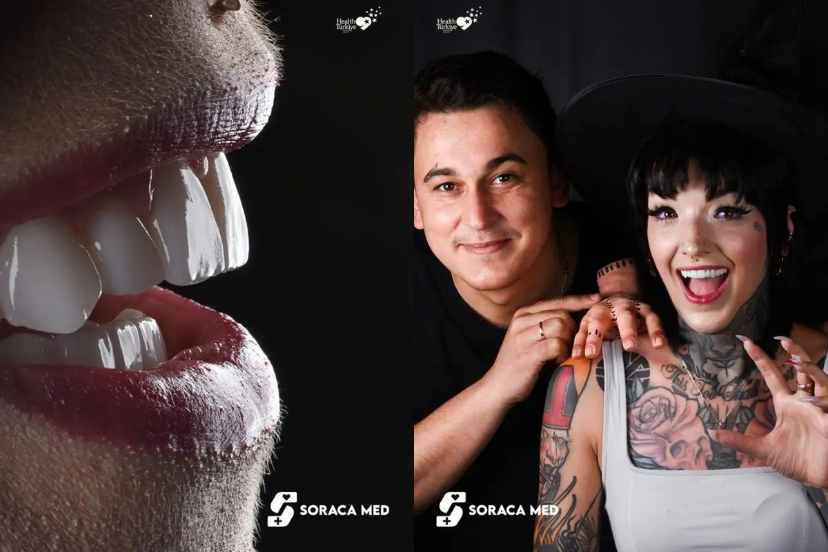 Faktoren Beeinflussen Veneers Kosten