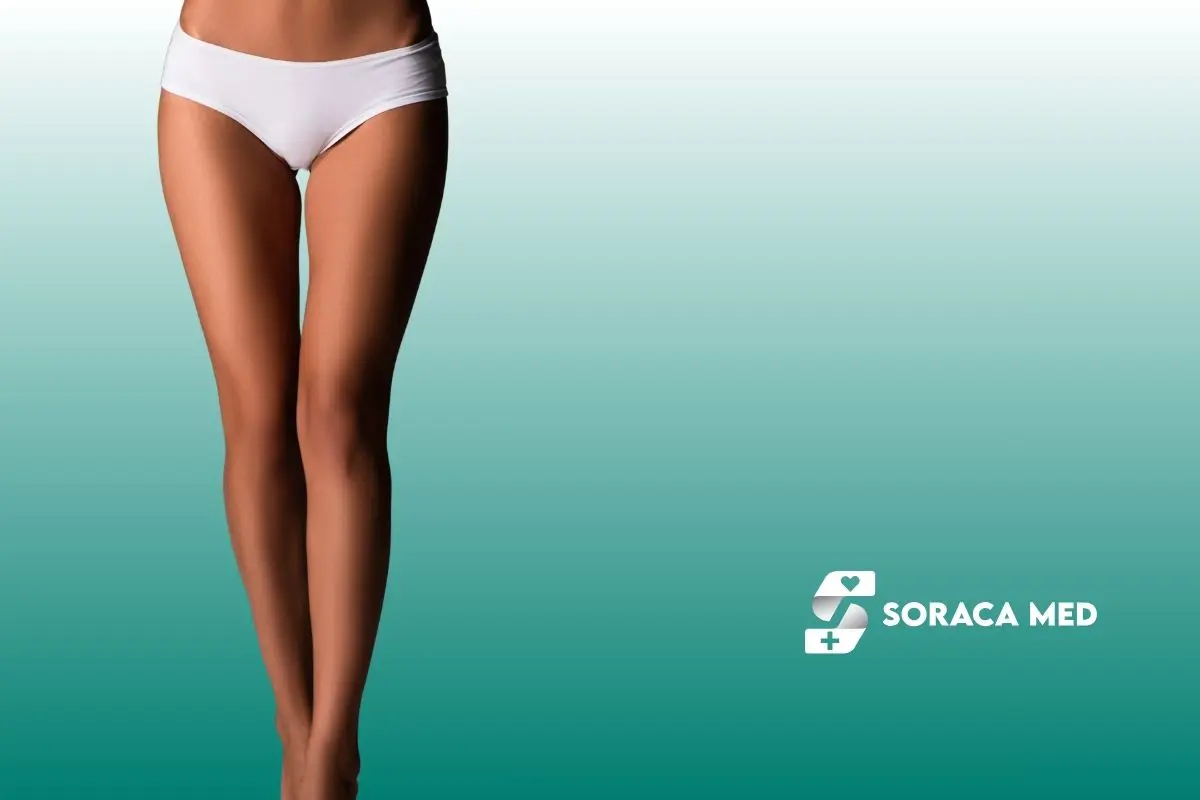 Liposukcja ud w Turcji: cena, efekty i rekonwalescencja 3 Liposukcja Ud W Turcji: Cena, Efekty I Rekonwalescencja