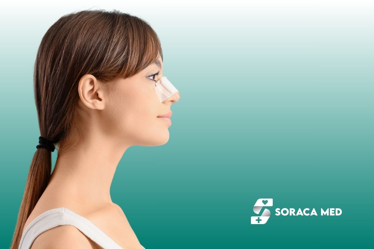 Nosies operacija: kaina, rinoplastika, gijimas ir rezultatai 3 Nosies Operacija Atsiliepimai