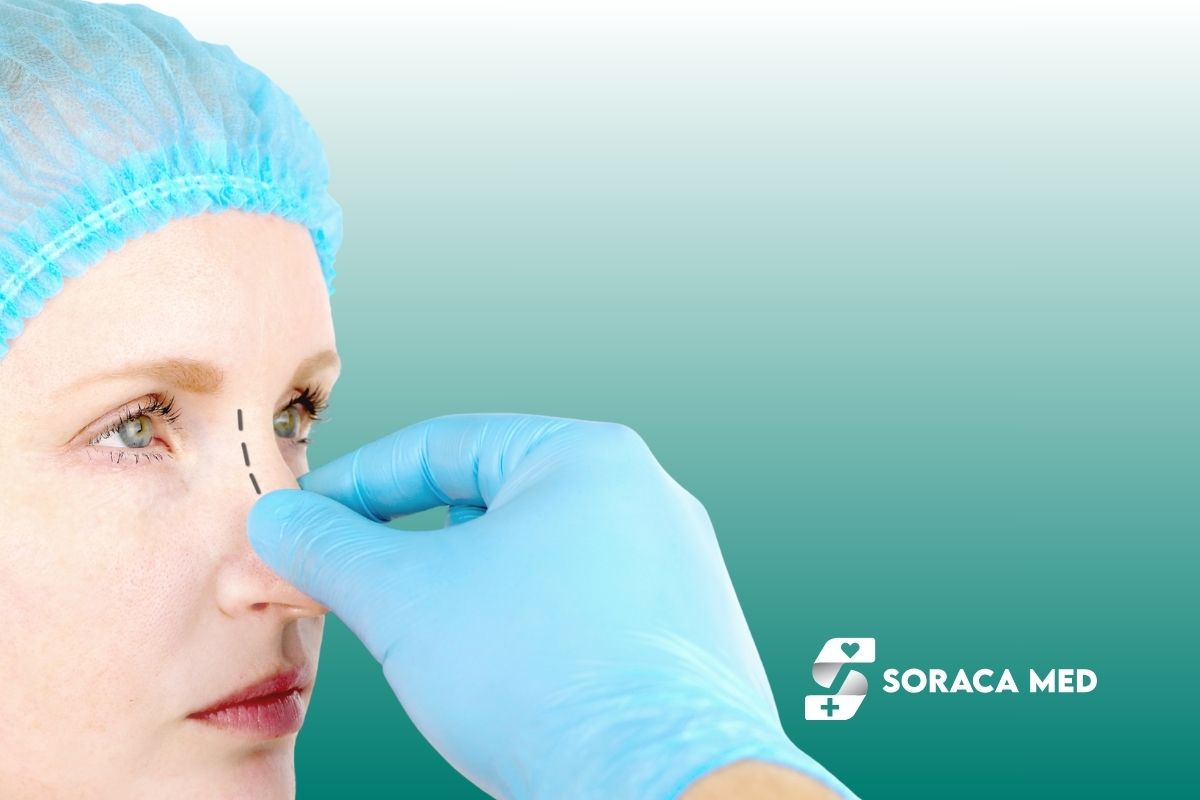 Nosies operacija: kaina, rinoplastika, gijimas ir rezultatai 2 Nosies Operacija: Kaina, Rinoplastika, Gijimas Ir Rezultatai