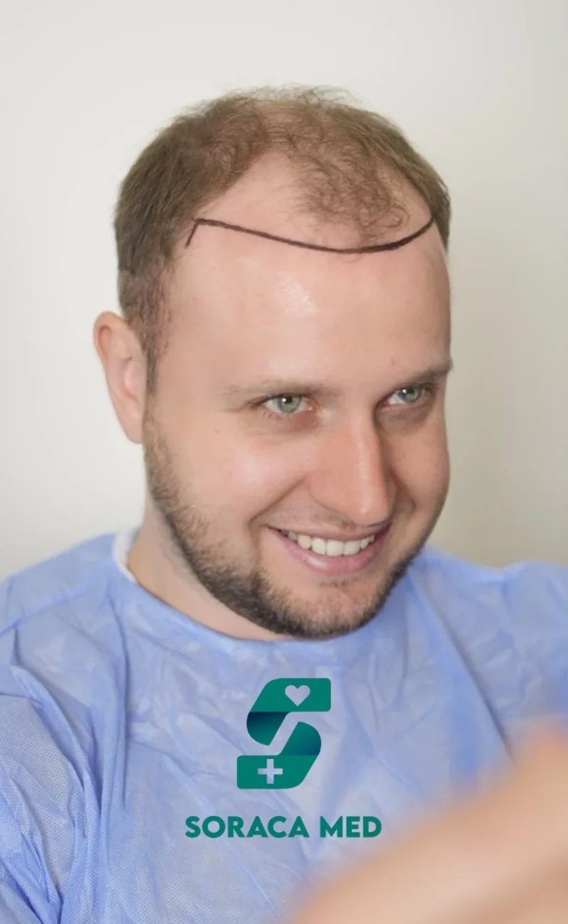 Soraca Med Hair Patients